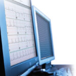 Holterový analyzátor Pathfinder