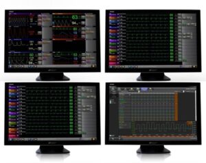 Monitorovacia stanica Xhibit