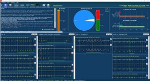 Softvér na analýzu EKG záznamov LifeScreen Pro Softvér na analýzu EKG záznamov LifeScreen Pro